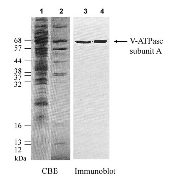 western blot using anti-V-ATPase subunit A antibodies